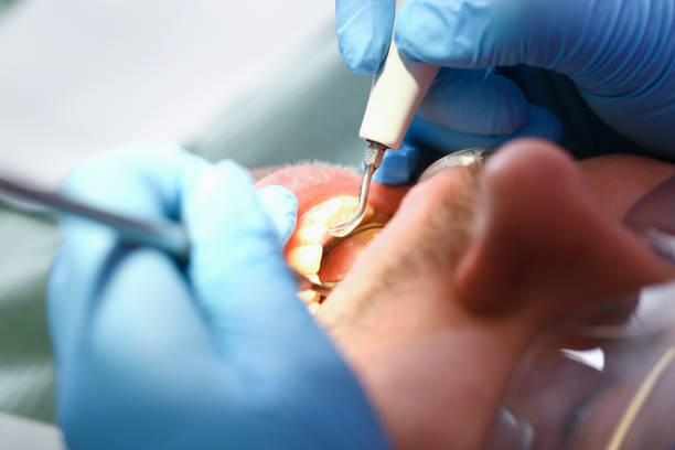 Best Emergency Dentist for Lost Fillings or Crowns in New Boston, TX