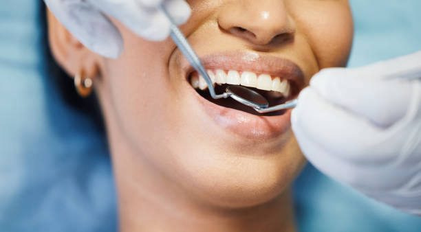 Best Emergency Dental Care for Abscessed Tooth in New Boston, TX