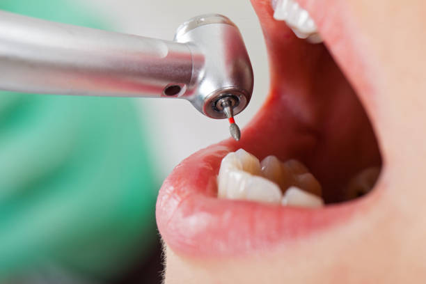 Best Broken or Cracked Tooth Emergency Dentist in New Boston, TX